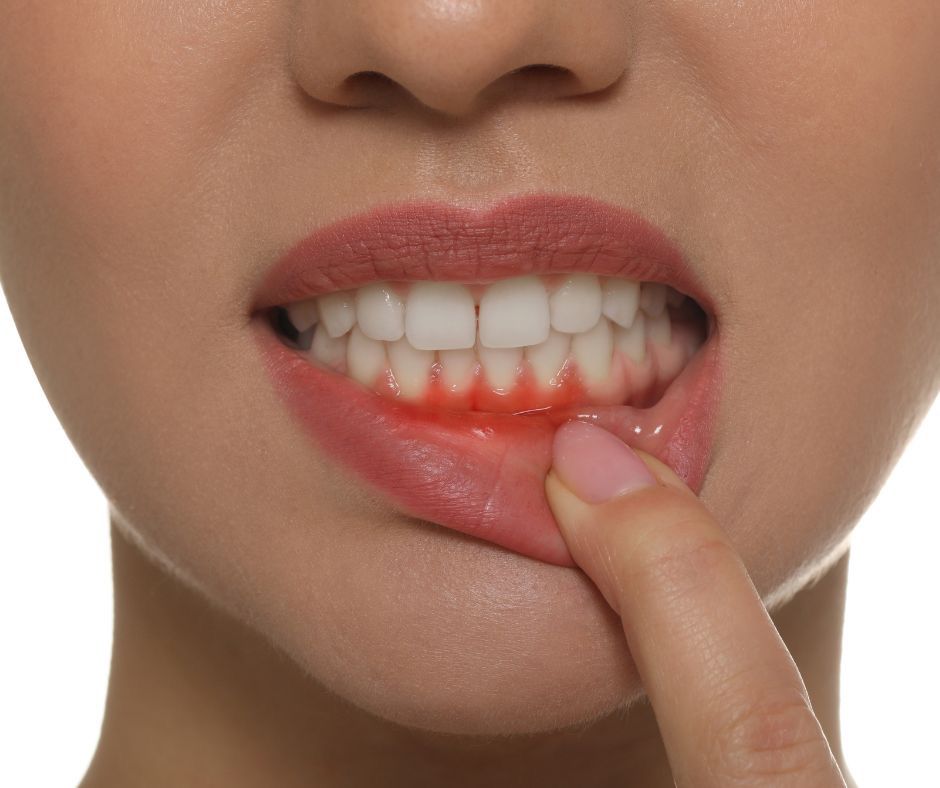 Doença Periodontal: o inimigo silencioso da saúde bucal